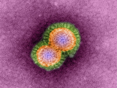 Il virus H5N1