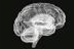 Ecco il primo cervello artificiale: misura 4 millimetri - Centro Meteo Italiano