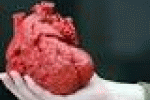 Con un cuore stampato in 3D salvato un bimbo di 14 mesi - ANSA.it